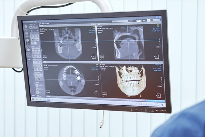 歯科用 CT